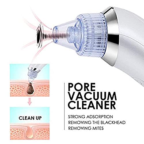 Derma Suction Blackhead Remover - Cell Operated Vacuum Pore Cleaner | 3 Power Levels | USB Rechargeable | Painless Comedone Extractor for Face/Nose | Includes 4 Suction Heads - Image 3