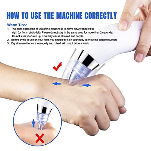 Derma Suction Blackhead Remover - Cell Operated Vacuum Pore Cleaner | 3 Power Levels | USB Rechargeable | Painless Comedone Extractor for Face/Nose | Includes 4 Suction Heads - Image 5